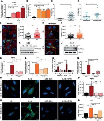 IL1β Promotes TMPRSS2 Expression and SARS-CoV-2 Cell Entry Through the p38 MAPK-GATA2 Axis
